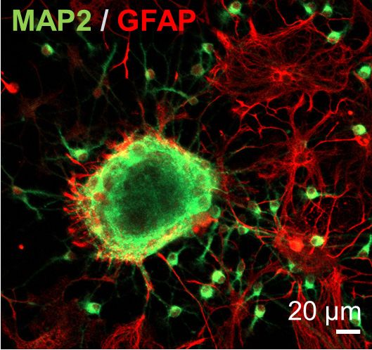 A microscopic view of brain tissue coloured to distinguish between different types of tissue