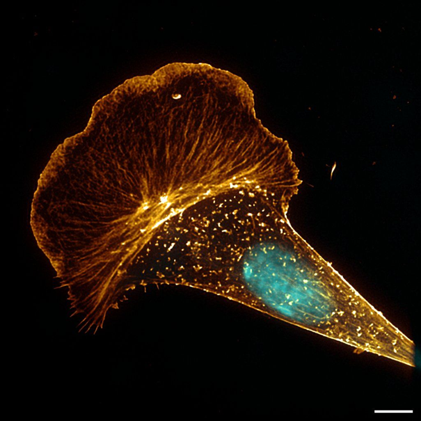 The actin cytoskeleton (and nucleus) of an Antarctic fish cell in culture (scale bar 5 μm)